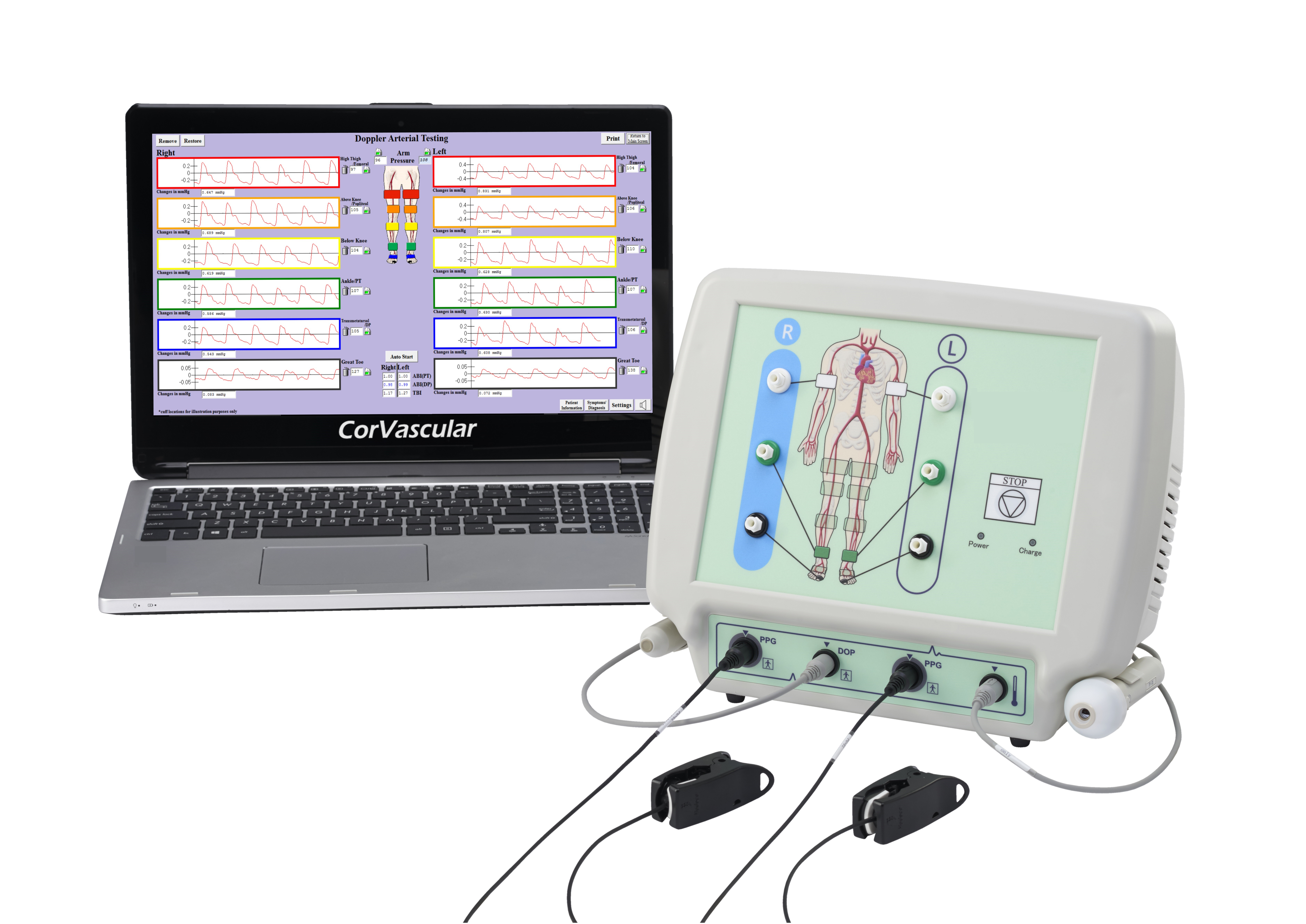 VasoGuard F6 Detail View